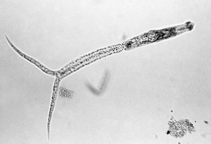 Cercaria of Schistosomas